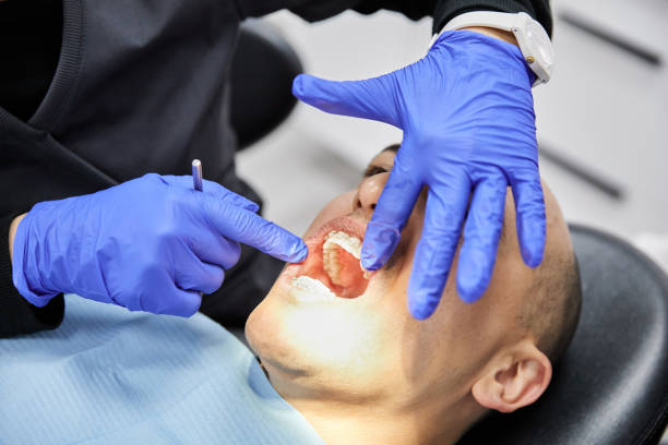 Best Knocked-Out Tooth (Avulsed Tooth) Treatment in Old Orchard, PA